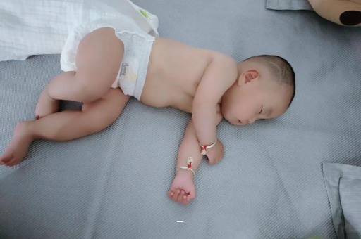 昆山宝宝脸上有白色斑块